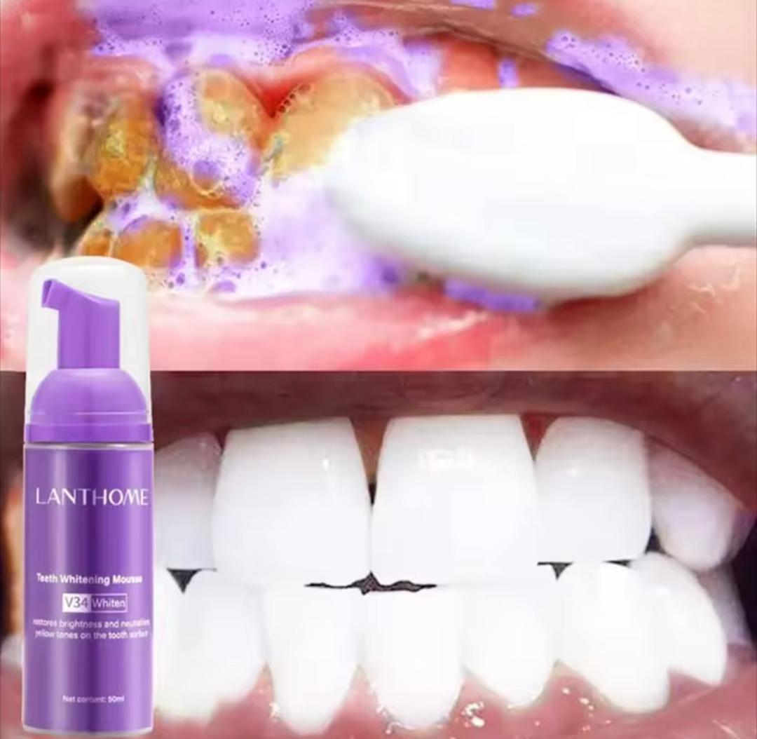 Mousse de Blanchiment des Dents V34 de LANTHOME !